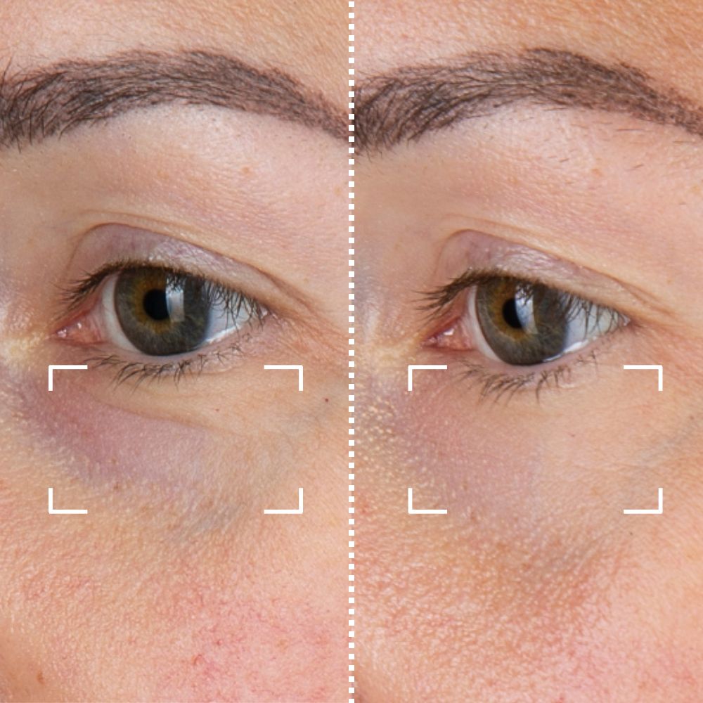Before & After