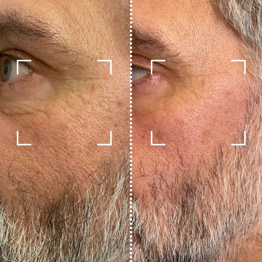 Before & After