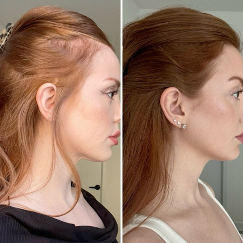 Before & After
