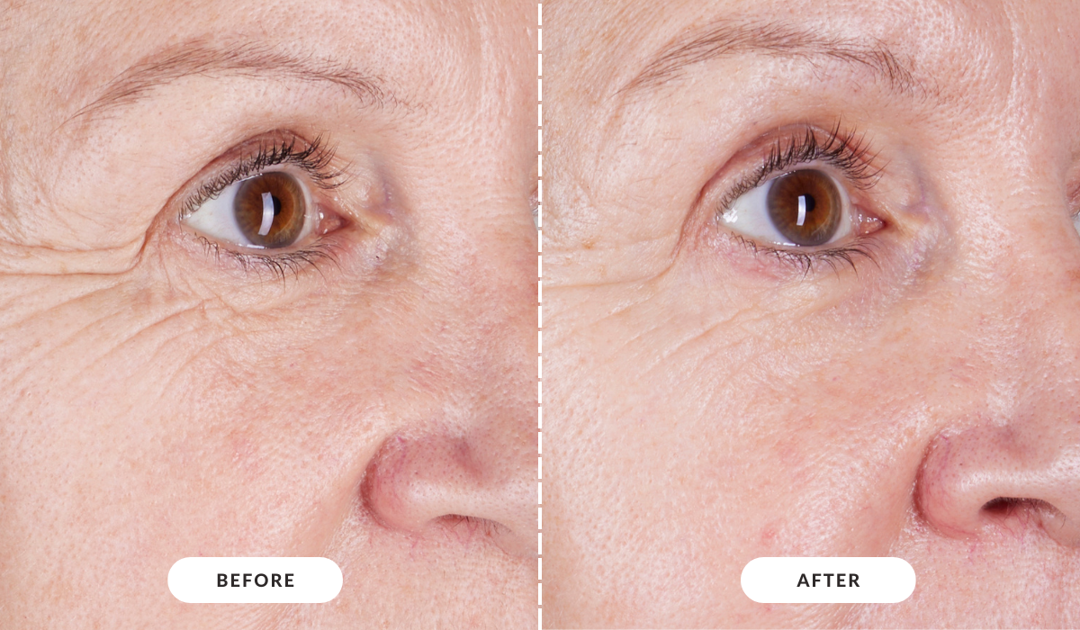Before & After