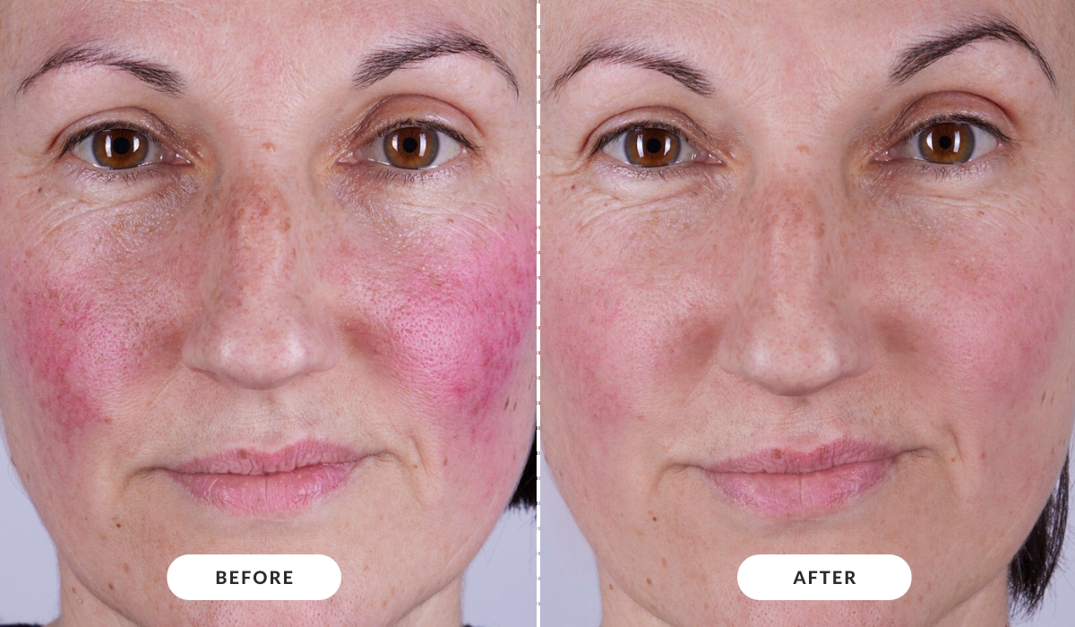 Before & After
