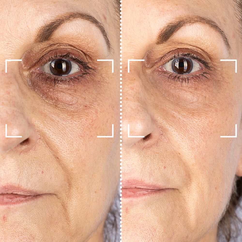 Before & After