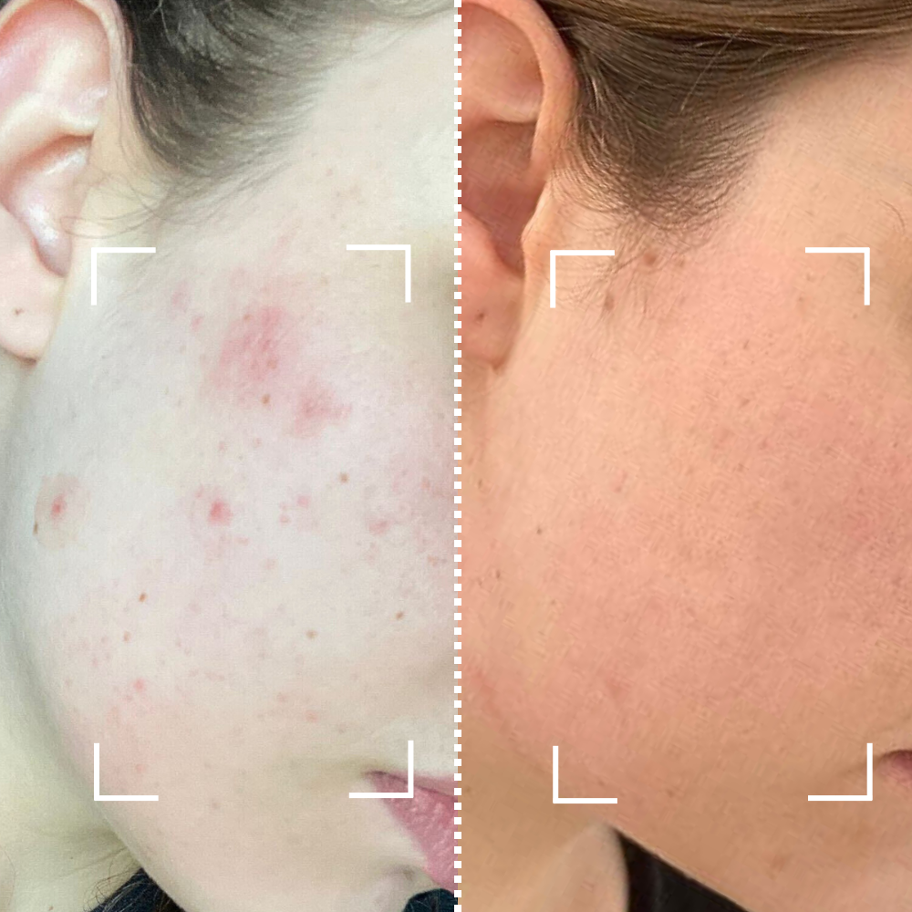 Before & After