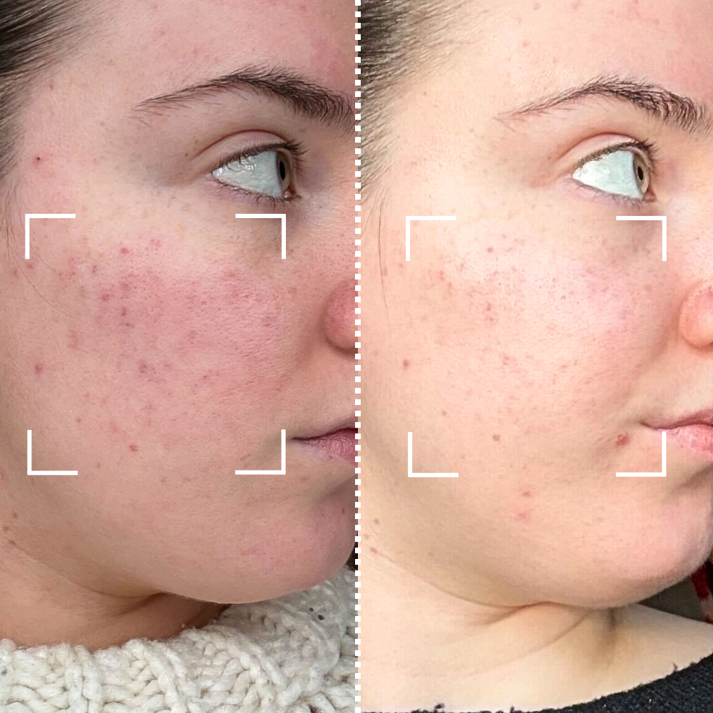Before & After