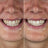 Promotes healthy gums