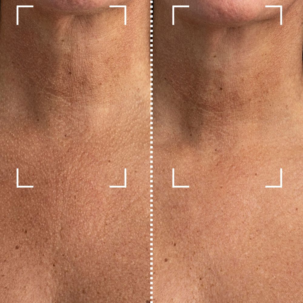 Before & After